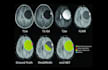 do medical imaging processing with ml, dl, computer vision