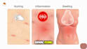 create 3d medical animation medical explainer video medical procedures animation