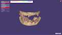 design a full mouth hybrid prothesis on exocad