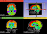 annotate medical images, xrays, ct,mri scans for machine learning ai models