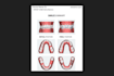 do dental clear aligners treatment planning,setup design on onyxceph software