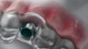 do 3d dental animation, 3d implant animation, 3d surgery animation, 3d medical