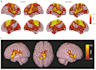 build tailored multimodal neuroimaging pipelines