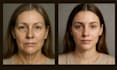 do professional photo editing, skin, airbrush clean