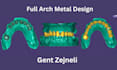 create high quality dental restorations using exocad