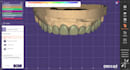 design crown, bridges, onlay and endocrown on exocad