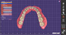 design premium complete denture your patient deserve