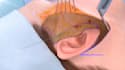 create realistic and cgi 3d medical animation for surgery procedures