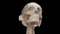 create accurate 3d medical animations for education and healthcare