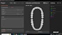 install and configure exocad elefsina 3 2 software and keygen