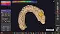 setup exocad 3,2 and partial cad software with guarantee