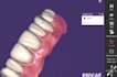 create dental restorations using exocad