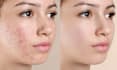 do high end skin retouching and portrait editing