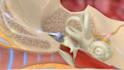 create 3d medical animation medical explainer ear surgical procedure animation