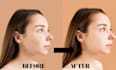 retouch your skin ,remove your pimples and acne
