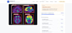build a medical imaging ai model to detect diseases