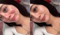 remove professionally acne or retouching only 10 mint