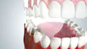 oral cgi 3d cgi medical animation 3d explainer video  high quality dental medica