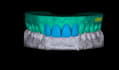 design dental waxup dsd using exocad