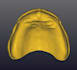 create  designs digital complete denture using exocad