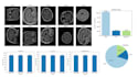 do image classification project using deep learning