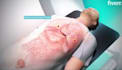 do 3d medical device animation 3d surgical device animation 3d medical explainer