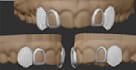 3d cad grillz as diverse and as quickly as possible