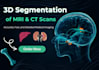 perform medical imaging segmentation and 3d visualization for ct mri