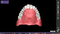 design dental devices using exocad and meshmixer