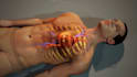 create 3d medical device animation and surgical procedure video