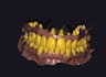 design a dental mock up design using exocad