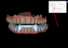 design a custom dental michigan night guard