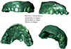 design custom gem set grillz cad from your teeth scan