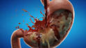 create 3d medical animation, medical explainer video and anatomy animation video