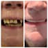 exocad implant dental design