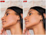 professional skin retouching, face retouch, blemish removal