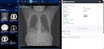 setup teleradiology complete system