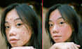 remove all the pimples and acne from your photo