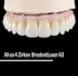 design dental digital projects exocad, 3shape, blender