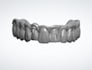 design dental crowns, bridges and implants using exocad