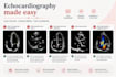 tutor echocardiography with real echo cases on zoom