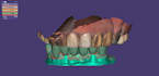 design dental prothesis all on using exocad