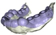 design a surgical guide for implant surgery