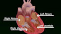 do 3d medical animation cardiac flow therapy 3d moa educational explainer video