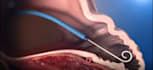 create 3d medical surgery procedure  human body anatomy animation