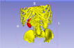 do ct and mri scans segmentation using 3d slicer