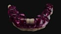 design precise surgical guide