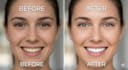 do professional skin retouching and remove acne naturally