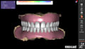 deisgn dental removable dentures