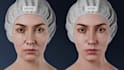 create professional 3d medical animation for cosmetic and aesthetic procedures